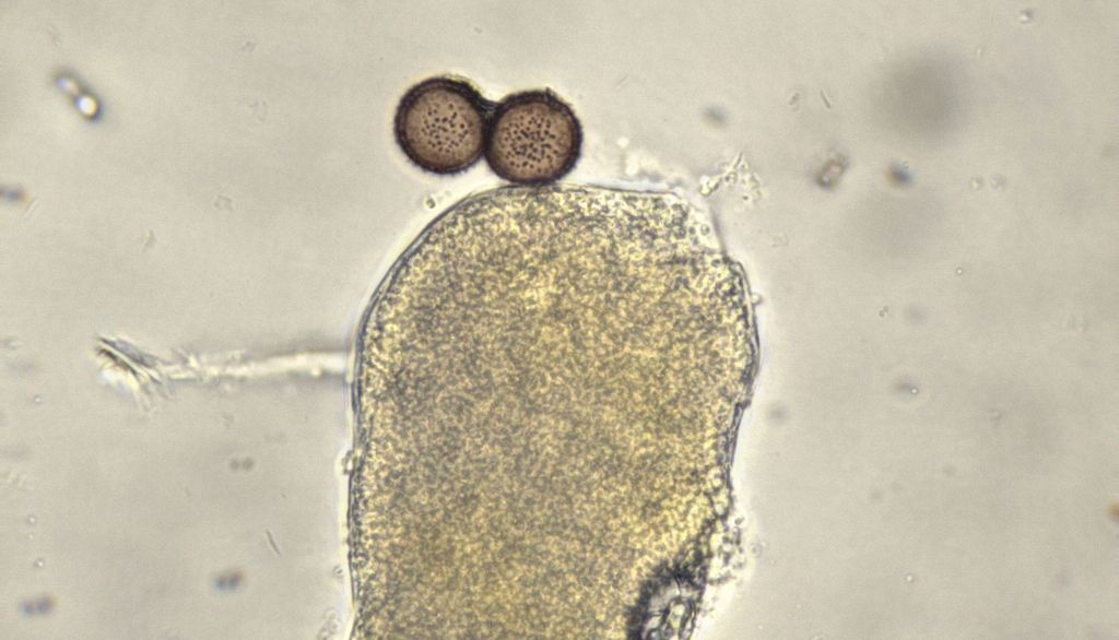 Physarum auriscalpium?